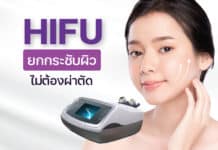 HIFU ยกกระชับผิว โดยไม่ต้องผ่าตัด
