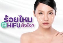 ร้อยไหม ต่างจาก Hifu อย่างไร
