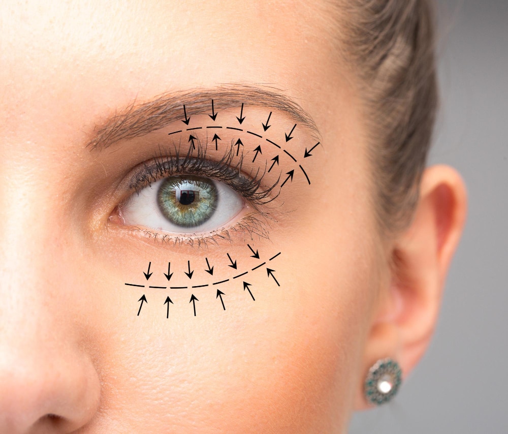 blepharoplasty-treatment-female-eye