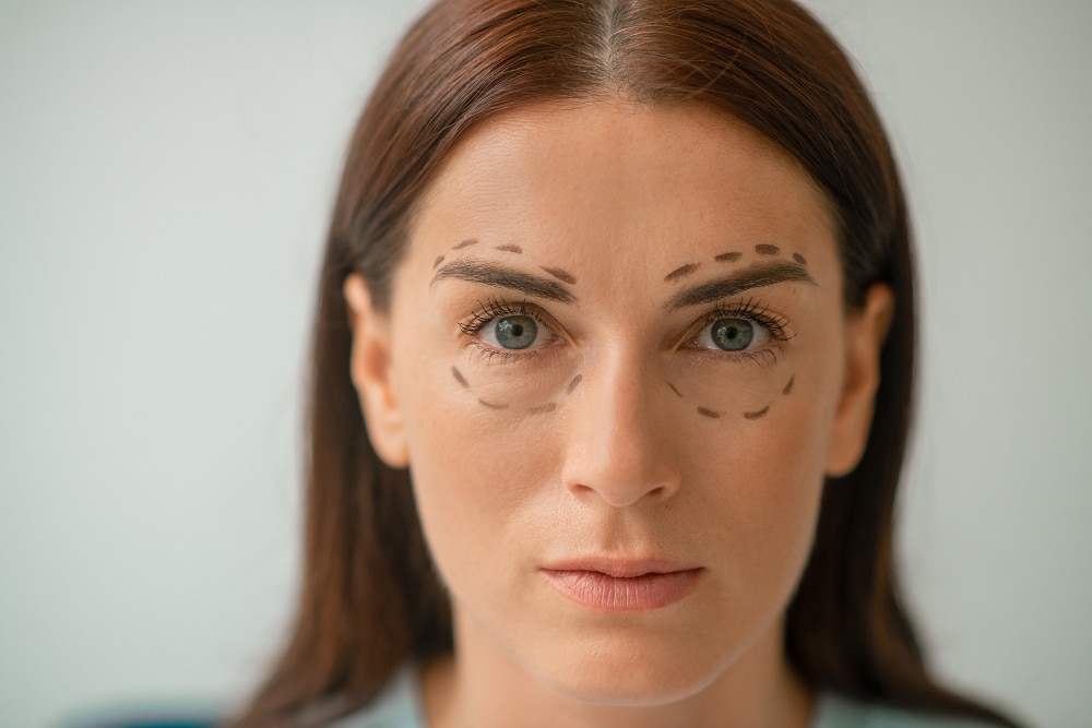 portrait-picture-woman-with-lines-eyes-area