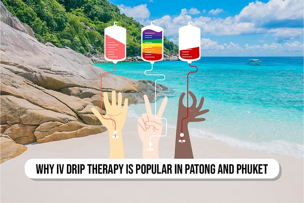 Why IV Drip Therapy is Popular in Patong and Phuket