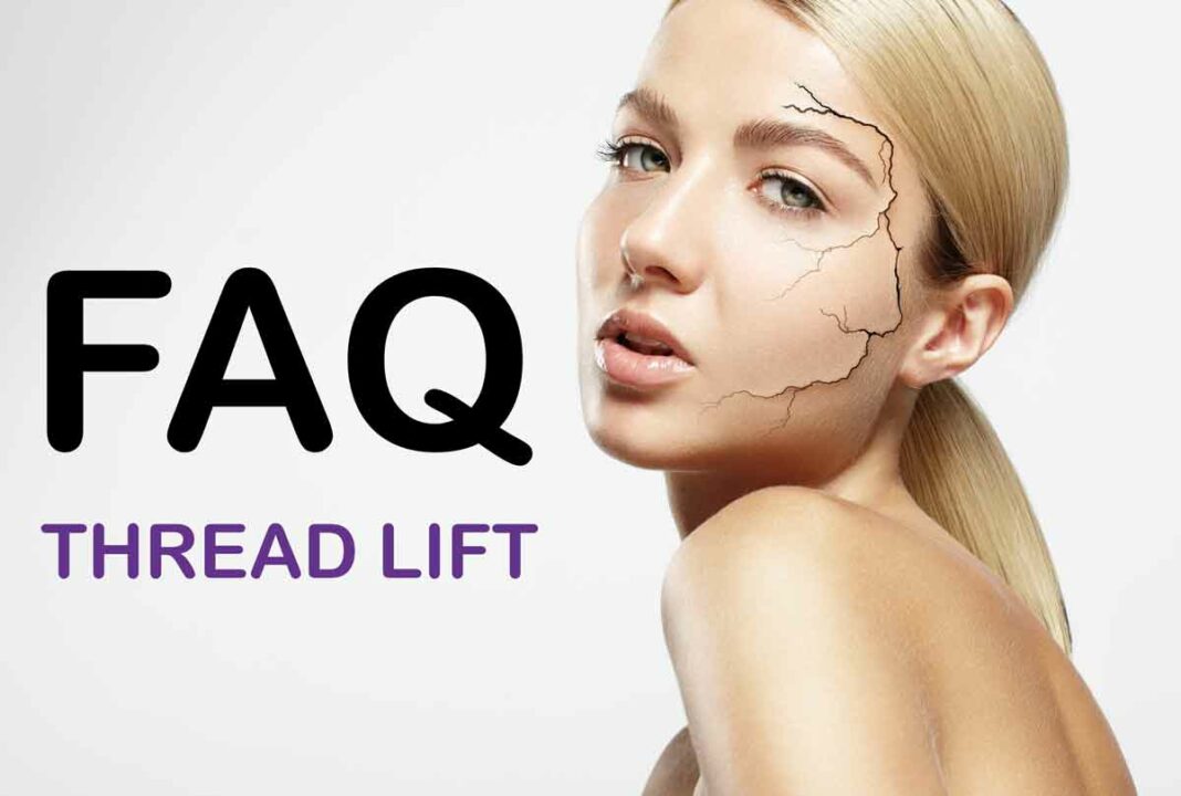 FAQ_thread_lift_pdo