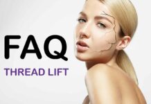 Frequently asked questions about Silhouette Thread Lift FAQ_thread_lift_pdo
