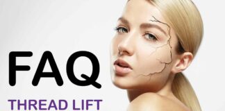 FAQ_thread_lift_pdo
