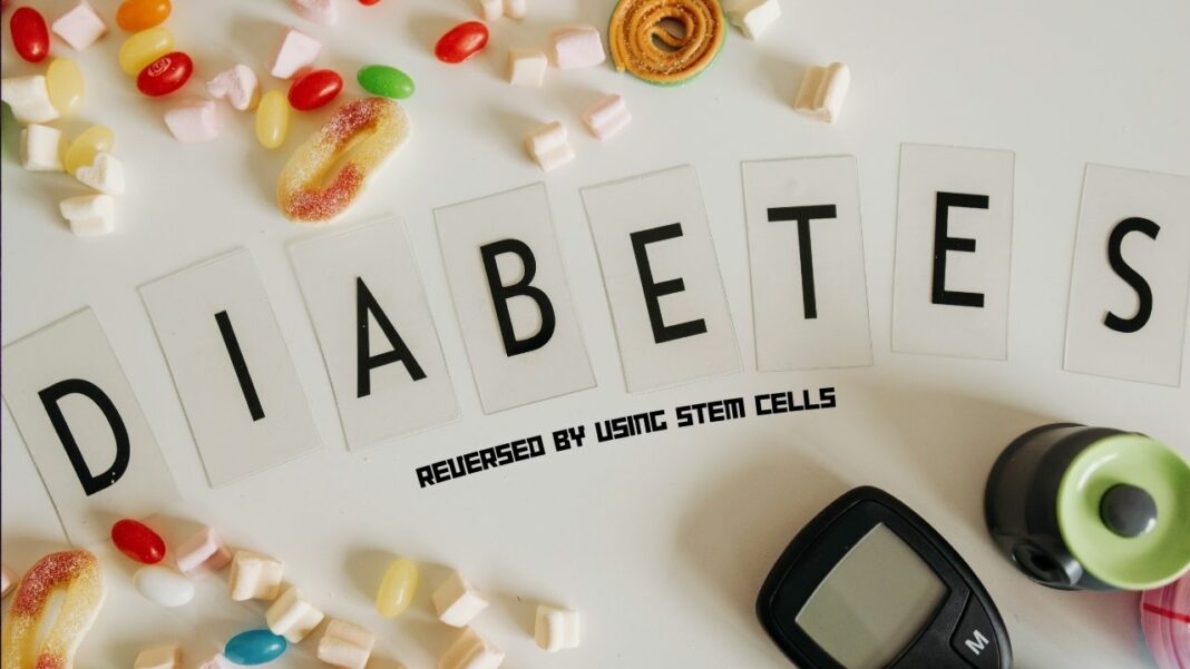 Stem Cells for Diebetes