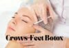 Smooth out fine lines around your eyes with crows feet Botox. Learn how it works, what results to expect, cost, safety, and FAQs—all in one easy guide.