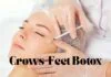 Smooth out fine lines around your eyes with crows feet Botox. Learn how it works, what results to expect, cost, safety, and FAQs—all in one easy guide.