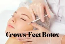 Smooth out fine lines around your eyes with crows feet Botox. Learn how it works, what results to expect, cost, safety, and FAQs—all in one easy guide.