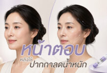 หน้าตอบหลังใช้ปากกาลดน้ำหนัก GIP/GLP-1 เกิดจากอะไร?